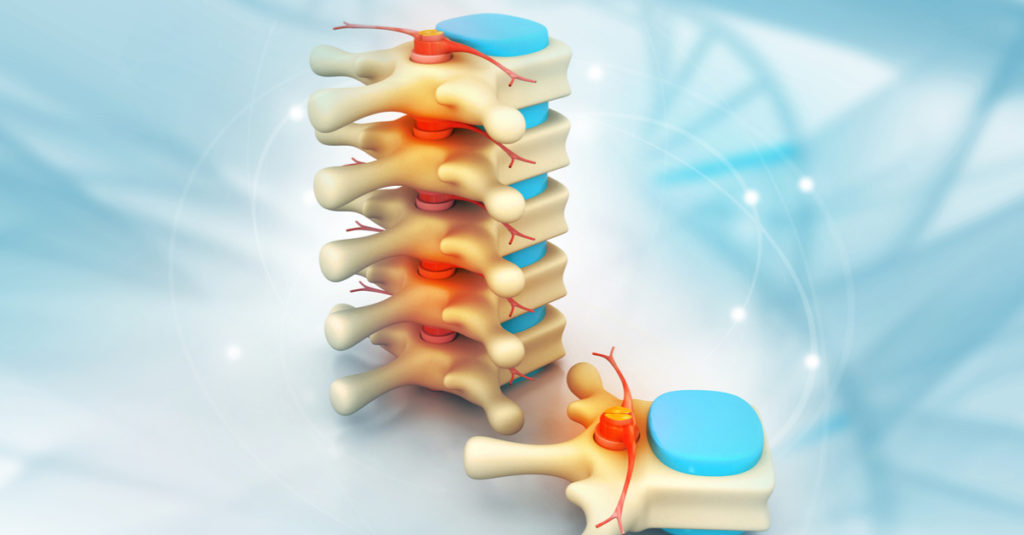 Understanding Minimally Invasive Spine Surgery